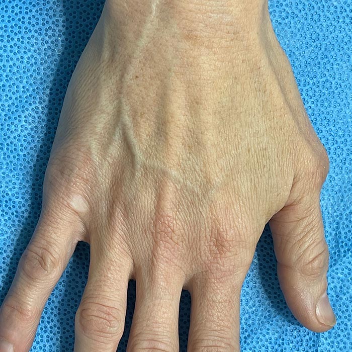 Ageing Hands